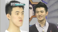 Những hình ảnh trước và sau phẫu thuật gây shock ở Hàn