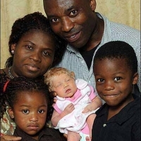 Bất ngờ: Cặp song sinh khác màu da của vợ chồng da đen