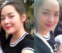 Cô gái Nam Định đẹp bất ngờ sau 3 tháng "dao kéo".Không thể tin vào mắt mình nữa :))
