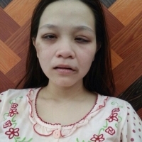 Em gái xinh tươi căng tròn bị chồng đánh bầm mặt - hot nhất trên face 24h qua
