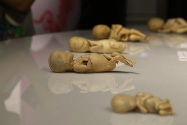 Ban tổ chức triển lãm xác người thật ở Sài Gòn: 'Phôi thai, thai nhi là mẫu hiến tặng được bố mẹ đồng ý'